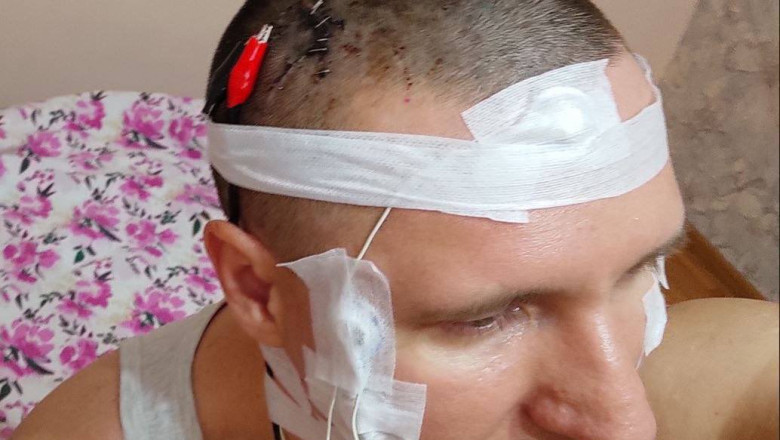 Rusya'da Adam Rüyalarını Kontrol Etmek İçin Kafasına Çip Taktı