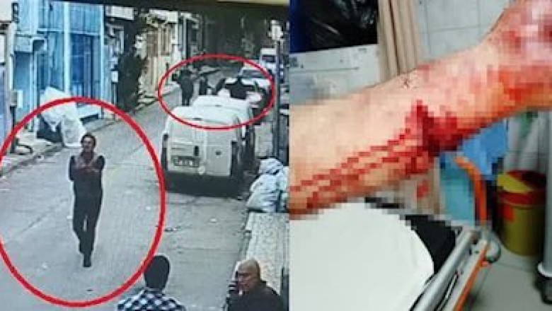 Bursa'da Pitbull Cinsi Köpeğin Husumet Sahibi Kişiyi Yaralaması Olayı İle İlgili İlginç Savunma