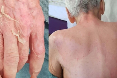 İzmir Huzurevi Olayında Dava Açıldı: Yaşlı Kadının Ölümüyle İlgili İddialar