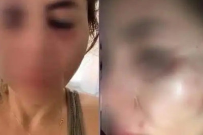 Mersin’de kedilere mama veren öğretmen darp edildi, şikayetçi olduğu saldırgan serbest bırakıldı